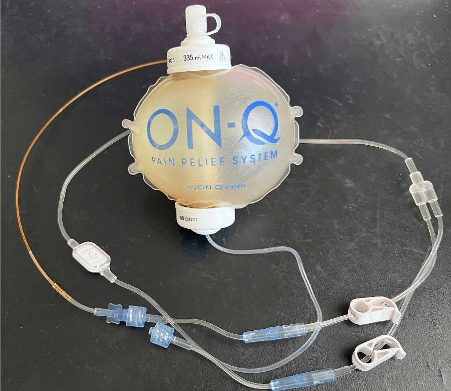 Pain Relief System ON-Q