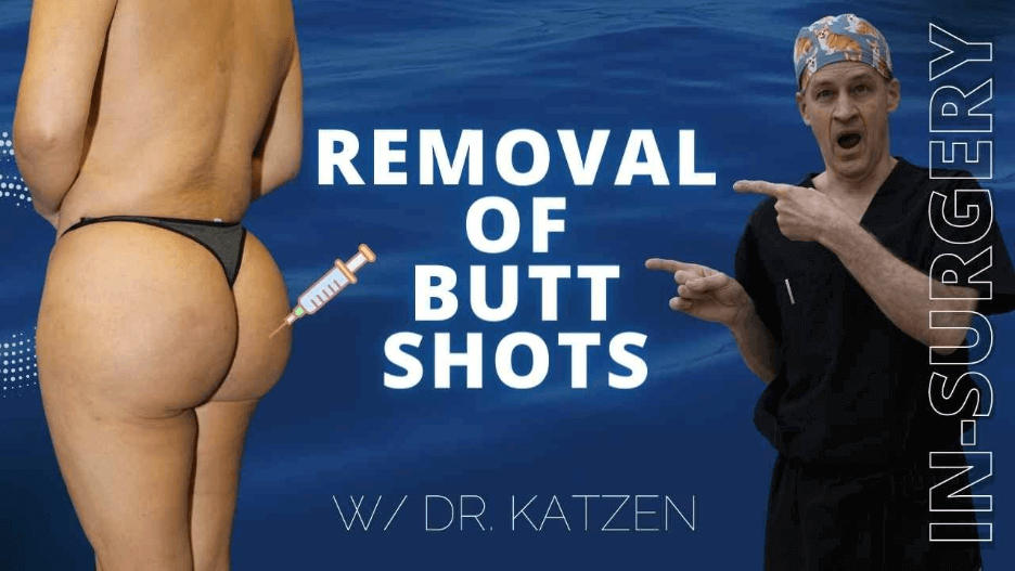 Removal of Butt shots